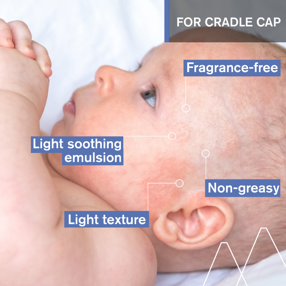 Uriage Baby's 1st Soothing Cradle Cap Care Regulating Cream 40ml