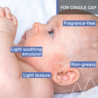 Uriage Baby's 1st Soothing Cradle Cap Care Regulating Cream 40ml