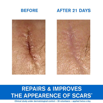 Uriage Bariederm Repairing Cica-Cream 100ml