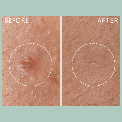Lierac Anti-Blemish Protocol The Stop Spots 15ml