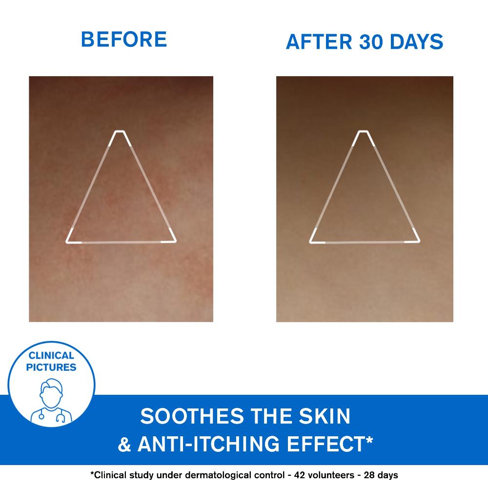 URIAGE XÉMOSE  Lipid-Replenishing Anti Irritation Cerat 200ml