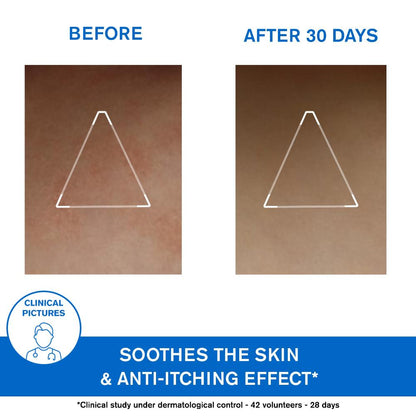 URIAGE XÉMOSE  Lipid-Replenishing Anti Irritation Cerat 200ml