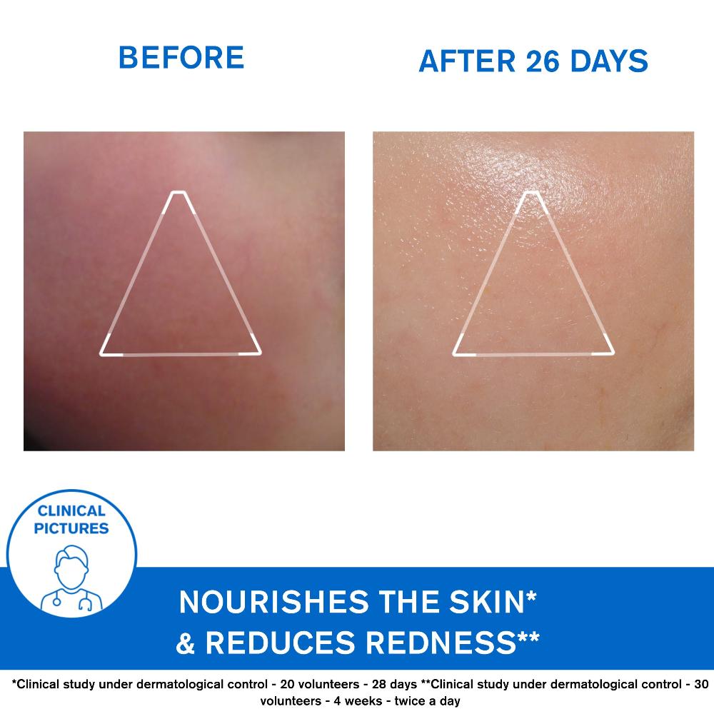 Uriage Xemose Nourishing Face Cream 40ml