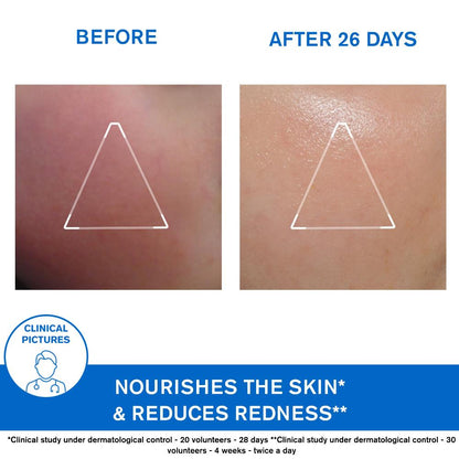 Uriage Xemose Nourishing Face Cream 40ml